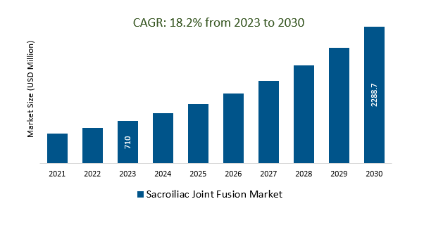 Sacroiliac Joint Fusion Market Size 2023-2030